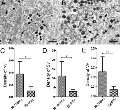 Drp1 Regulated Mitochondrial Hypofission Promotes the Invasion and Proliferation of Growth Hormone-Secreting Pituitary Adenomas via Activating STAT3